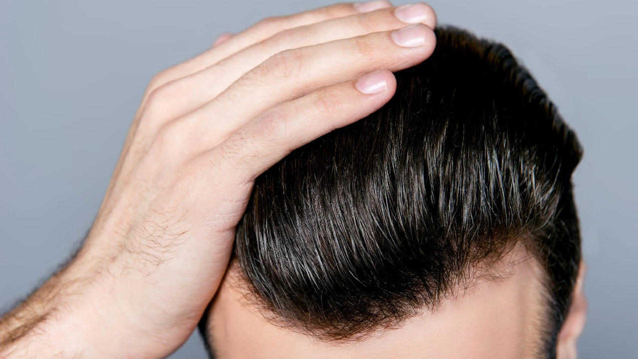 man with good hair after hair transplant
