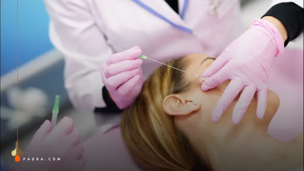 a person undergoing a thread lift