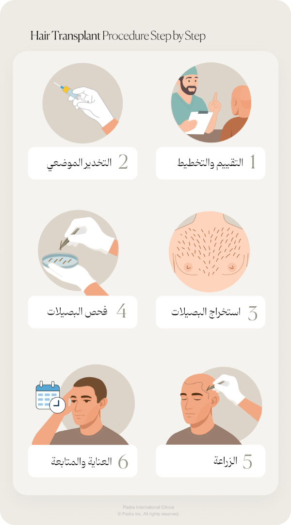 زراعة الشعر من شعر الجسم BHT