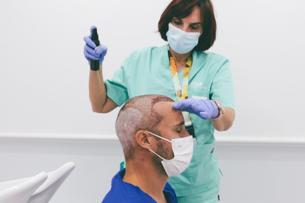 Spray after hair transplantation