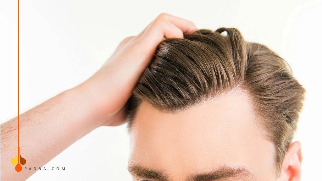 widow's peak hairline