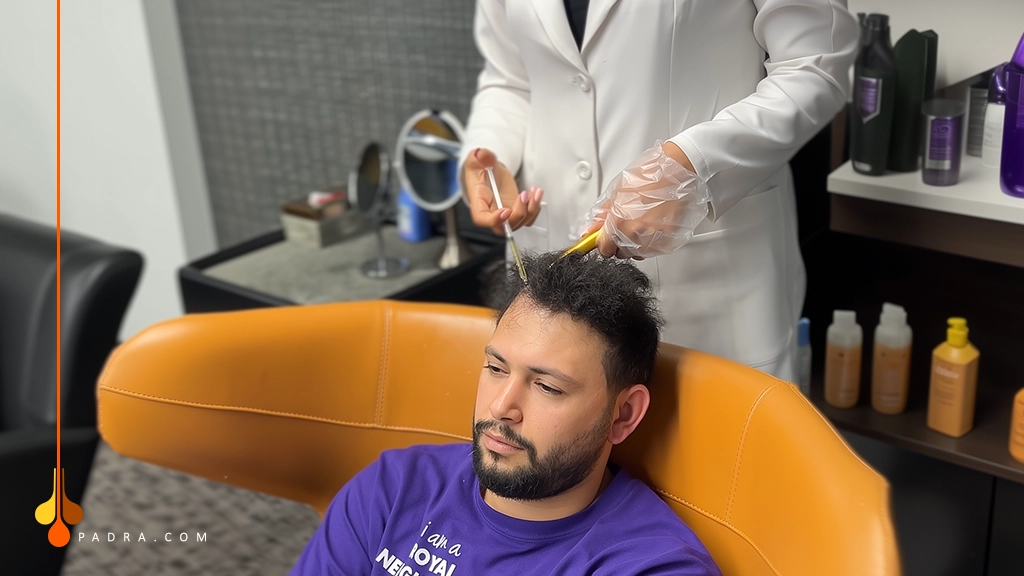 prp for hair restoration