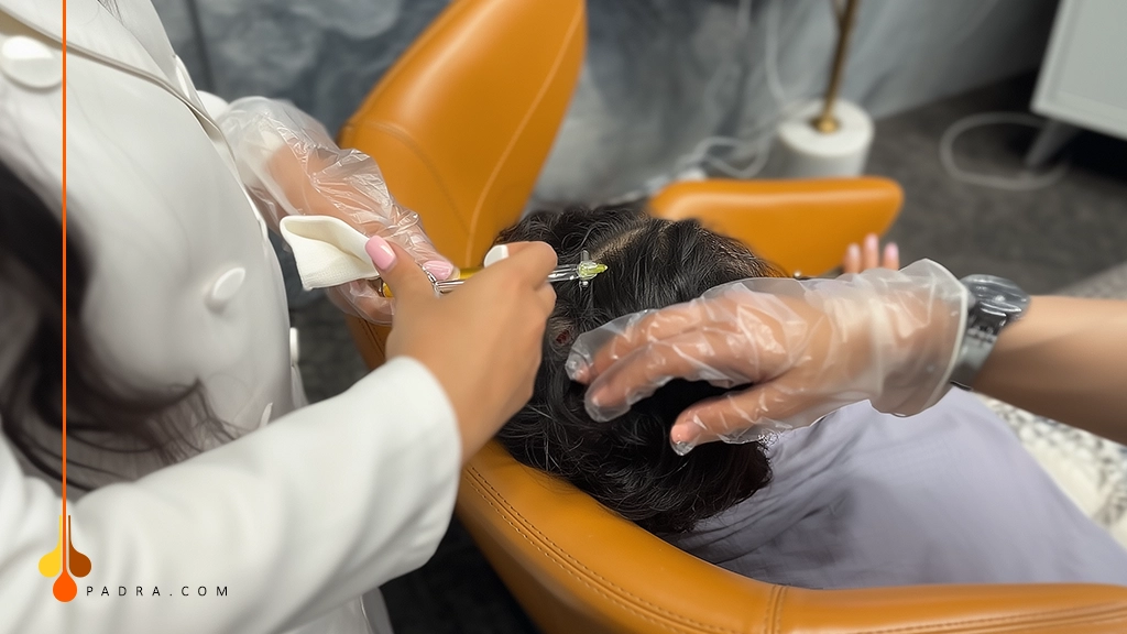 hair filler for hair restoration