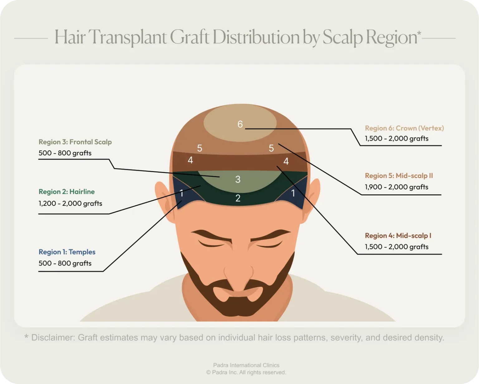 عدد البصيلات المطلوبة لزراعة الشعر