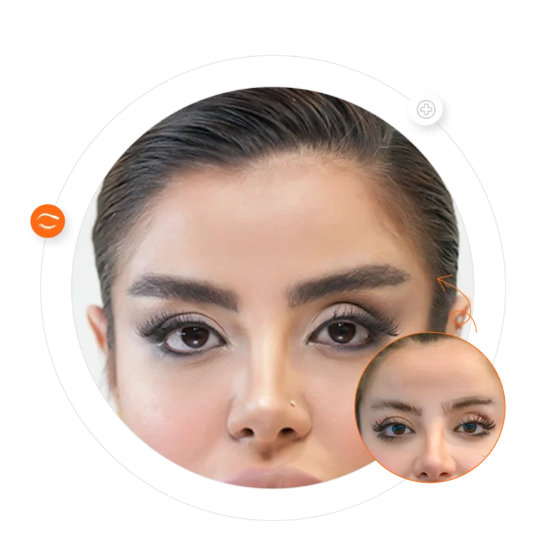 Natural eyebrow transplant results in Qatar