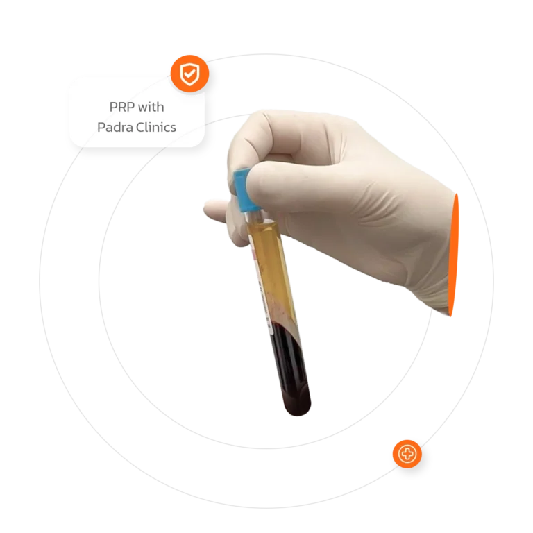 PRP hair restoration results in Riyadh