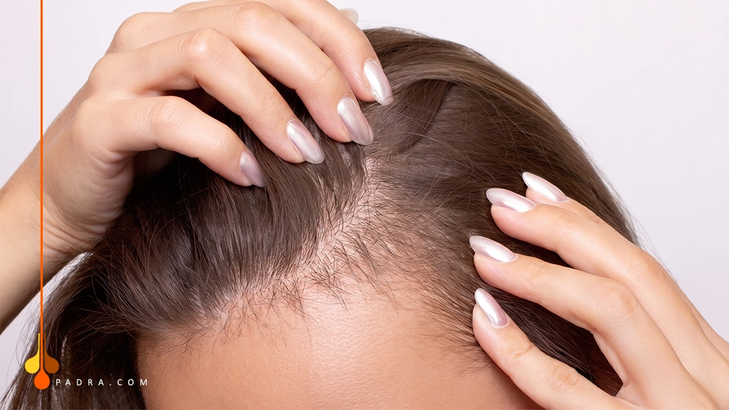 Causes Hair Follicles